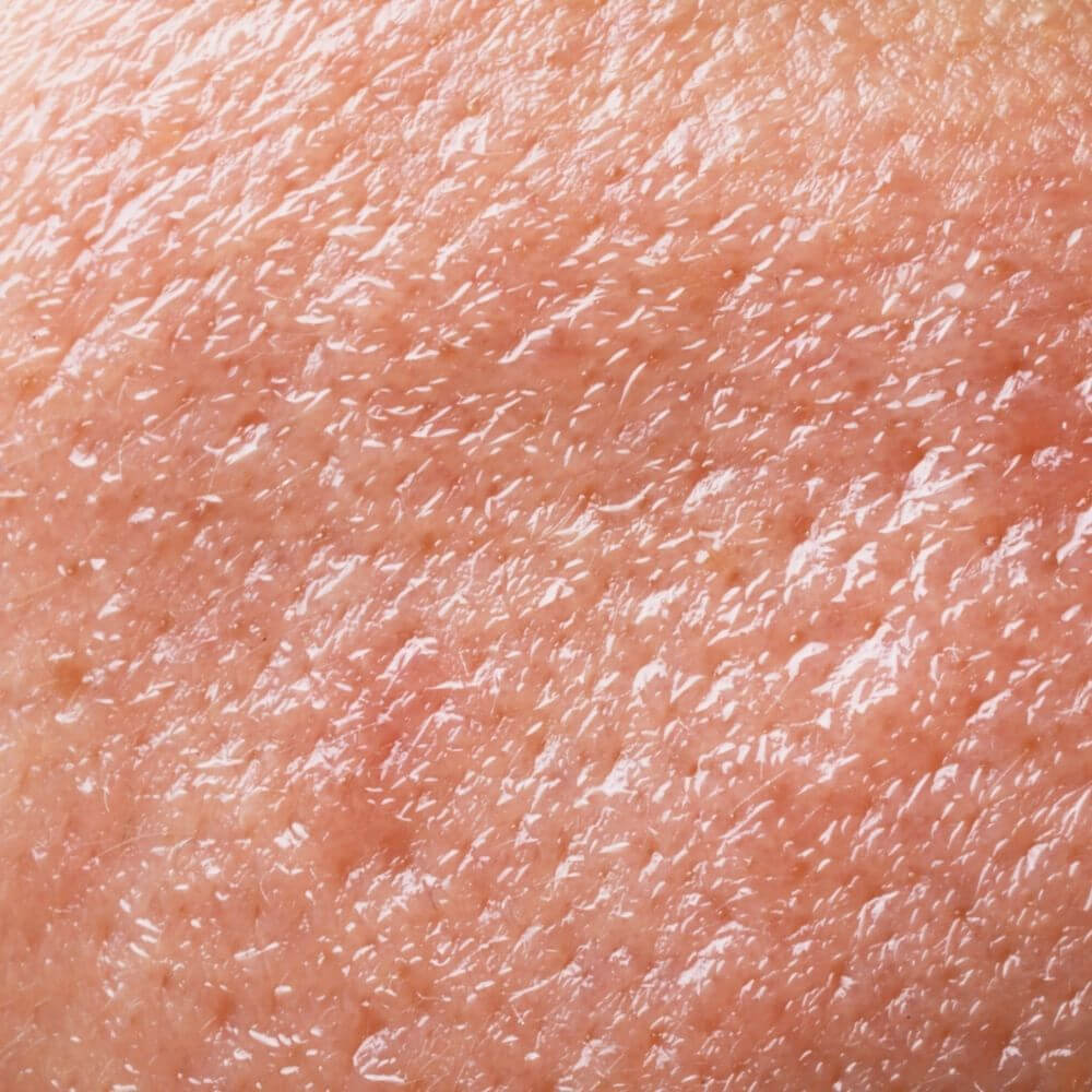 Routine peau mixte à grasse